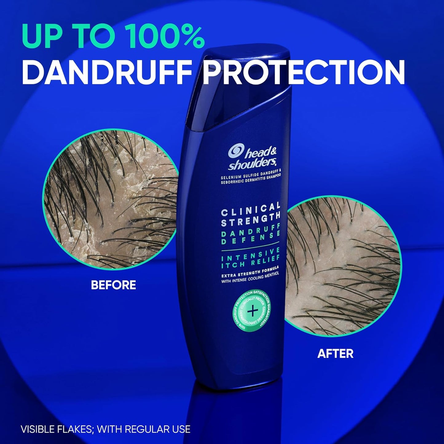 Head & Shoulders Clinical Dandruff Shampoo Twin Pack, Advanced Oil & Flake Control, Selenium Sulfide for Seborrheic Dermatitis Relief, Prescription Strength Scalp Care, Refreshing Citrus, 13.5 Oz Each